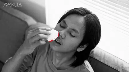 Tiba-Tiba Mimisan? Bisa Jadi Lo Kurang Minum atau Kebanyakan Scroll TikTok!